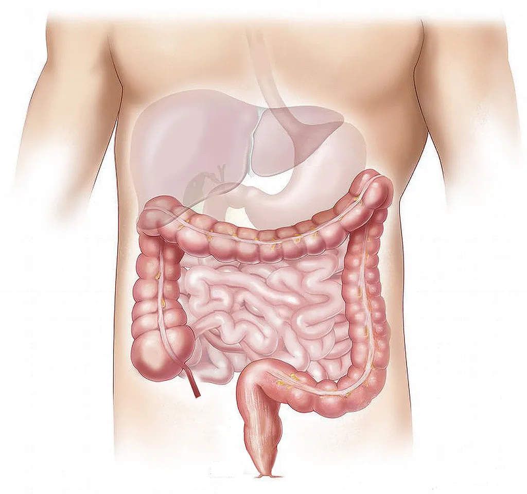 Fatores ambientes como alimentação saudável podem prevenir a evolução de bactérias prejudiciais ao aumentar a diversidade microbiana do intestino (Imagem: Elionas2/Pixabay)