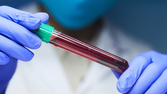 Exame de sangue detecta câncer em 2 horas - 1