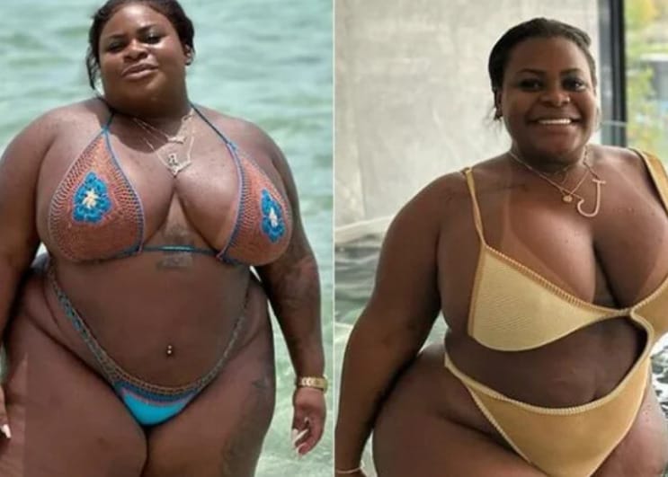 Jojo Todynho mostra antes e depois de cirurgia bariátrica e revela que já perdeu 33 quilos - 2