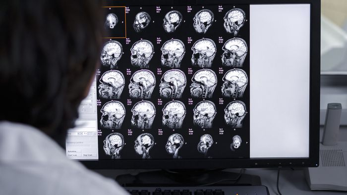 Brasileiros clonam tumor para combater câncer cerebral - 1