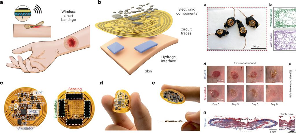 Curativo inteligente permite monitorar feridas remotamente - 2