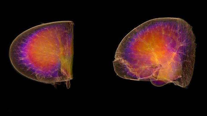 Doença renal cósmica: viagem a Marte pode causar danos aos rins - 1