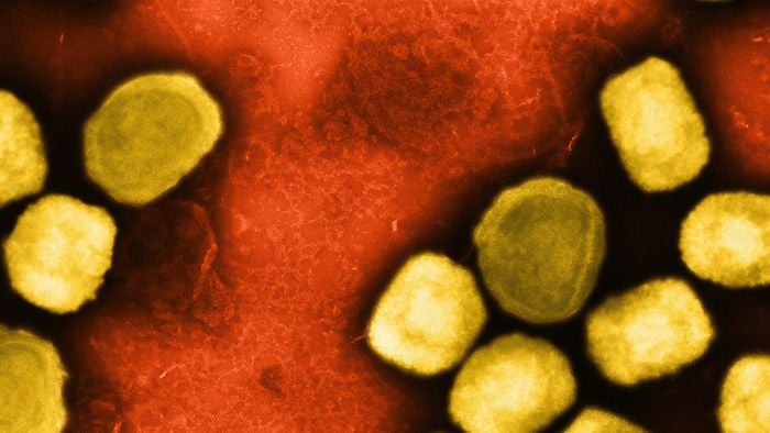 OMS alerta sobre nova variante de mpox e pede urgência - 1