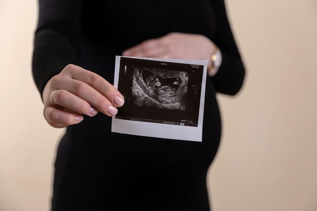 Febre oropouche pode ser transmitida da mãe para o bebê - 2